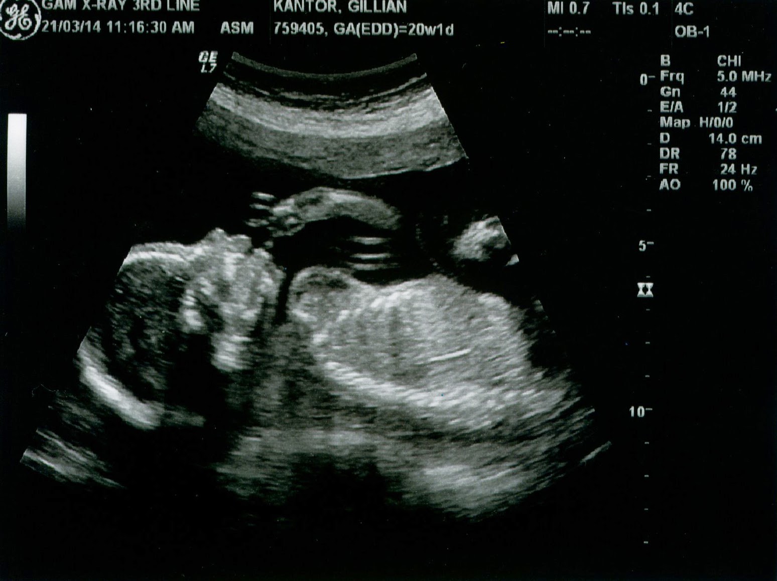 baby - sucking thumb-Credit-Gillian Kantor.jpg